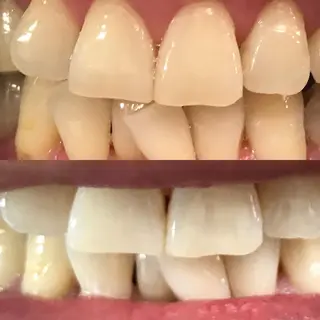 ネイリスト riiisaのネイルデザイン