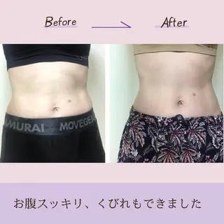 小顔エステサロン マインドール所属・泉大津エステ毛穴   シミ専門サロンのエステ・リラクイメージ