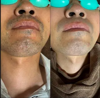 六本木脱毛andS 店長Sachiのエステ・リラクイメージ