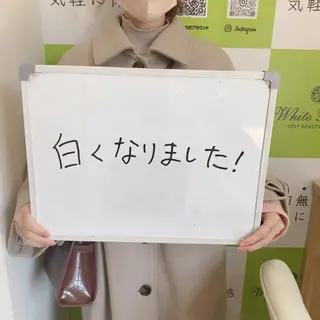 White Berry SELF BEAUTY SALON所属・セルフホワイトニング 🦷口元垢抜け✨のその他イメージ
