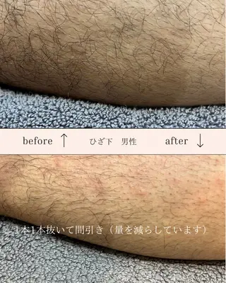 EPI Studioのエステ・リラクイメージ