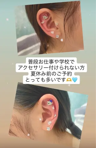 Kaula所属・Kaula ホワイトニング耳ツボのその他イメージ