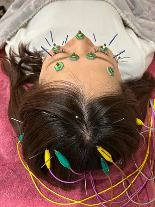 美容鍼灸女性専用 りんご鍼灸治療院のその他イメージ