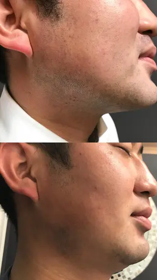 メンズ Lilyboo 池袋のエステ・リラクイメージ