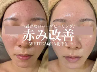 WHITE AQUA 北千住店のエステ・リラクイメージ