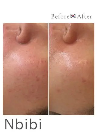 韓国🇰🇷価格 サロン_Nbibiのエステ・リラクイメージ