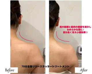 痩身×フェイシャル ブライダル|Linoのエステ・リラクイメージ