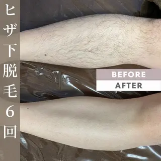 メンズ men's blanclis所属・メンズブランリス メンズ脱毛のエステ・リラクイメージ