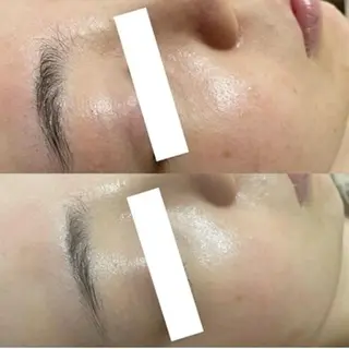 毛穴/小顔専門♡ アトリエリュバンのエステ・リラクイメージ