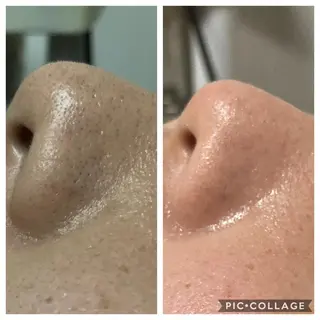 ハーブピーリング 専門／今榮麻美のエステ・リラクイメージ