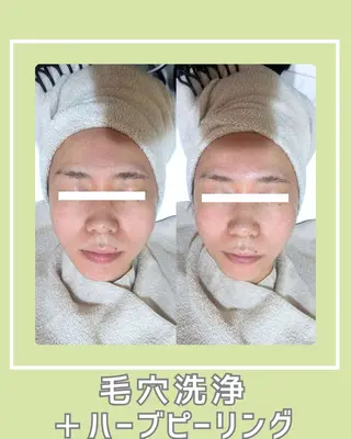 s o i n a🤍🪽ララピール／毛穴／小顔／水光肌所属・s o i n a 神楽坂のエステ・リラクイメージ