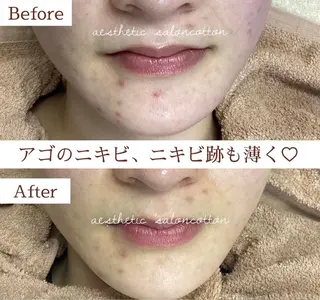 都度払い 肌質改善専門サロンのエステ・リラクイメージ