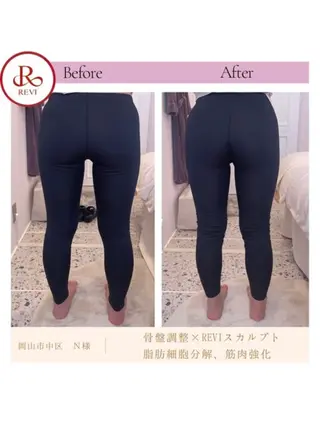 アンテインチル 山本のエステ・リラクイメージ