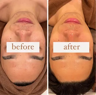 立体小顔×艶肌×美ボ ディ似合わせ施術 岡のエステ・リラクイメージ