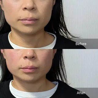 nail RiRi アトレナチュラのエステ・リラクイメージ