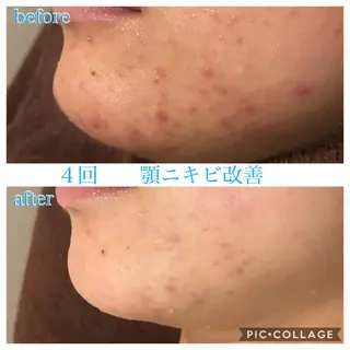 ロング カラー パーマ ヘアアレンジ メンズ キッズ ネイル マツエク・マツパ Ensor Clair所属・EnsorClair 代表 野口真央のエステ・リラクイメージ