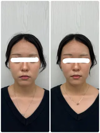 美容鍼×小顔矯正 ×美容整体 浜川泰仁のエステ・リラクイメージ