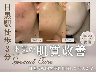 肌質改善 BELFINEのエステ・リラクイメージ