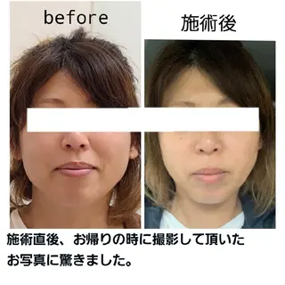 小顔と美肌 まごころエステMatoria所属・小顔 美肌専門 Matoriaのエステ・リラクイメージ