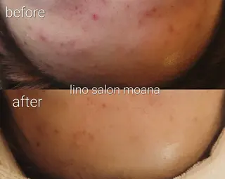lino salon moana所属・lino salon  moanaのエステ・リラクイメージ