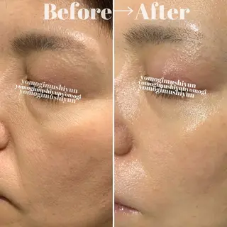 よもぎ蒸しエステサロン★yun所属・よもぎ蒸しサロン ゆんのエステ・リラクイメージ