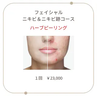 ベラージュ【美背中・ 美尻・フェイシャル】のエステ・リラクイメージ