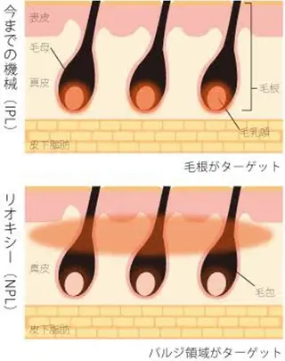 アイトータル ビューティーのエステ・リラクイメージ