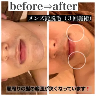 メンズ 美肌コラーゲン脱毛SINCERITE【サンセリテ】所属・瀬野 のぞみのエステ・リラクイメージ