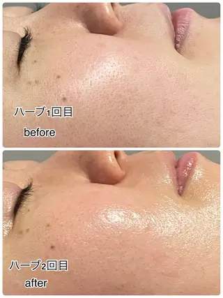 ENCHANT 脱毛.小顔.毛穴のエステ・リラクイメージ