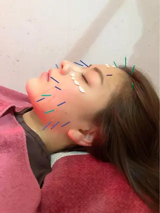 美容鍼灸女性専用 りんご鍼灸治療院のその他イメージ