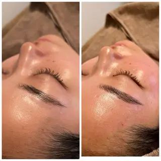 B&H所属・頭痛•肩こり専門/ 眉サロンB&H心斎橋のエステ・リラクイメージ