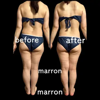 marron所属・痩身ハイパーナイフ ララピールリアボーテのエステ・リラクイメージ