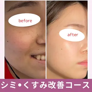 leolo武蔵浦和 肌質改善&脱毛のエステ・リラクイメージ