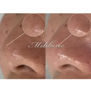 肌質管理 MIBLANC上野店のエステ・リラクイメージ