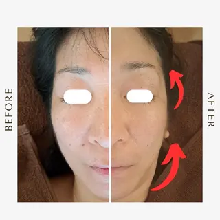 鍼灸サロンmiyabi所属・美容鍼×エステ　鍼灸 サロンmiyabiのエステ・リラクイメージ