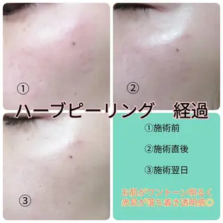 未病ケアサロン EMINY所属・未病ケアサロン EMINY☺︎勝俣のエステ・リラクイメージ