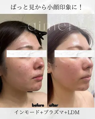 aimer SASAKIのエステ・リラクイメージ