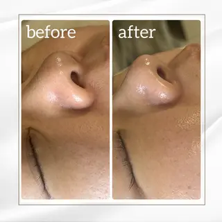 BEAUTY SALON R's所属・BEAUTY SALON R'sのエステ・リラクイメージ