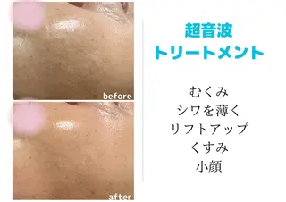 プライベートサロンCuara所属・プライベートサロン Cuaraのエステ・リラクイメージ