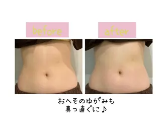 メンズ 癒し腸もみサロン シャユーム　ゆきなのエステ・リラクイメージ