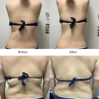 冷却専門店 SLARIのエステ・リラクイメージ