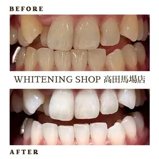 メンズ ホワイトニング ショップ高田馬場店のその他イメージ