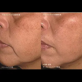 くびれ作り専門サロン こねこのシッポ虎ノ門のエステ・リラクイメージ