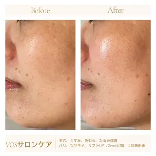 1ヶ月後も半分残る 高持続LEDエクステのマツエク・マツパデザイン