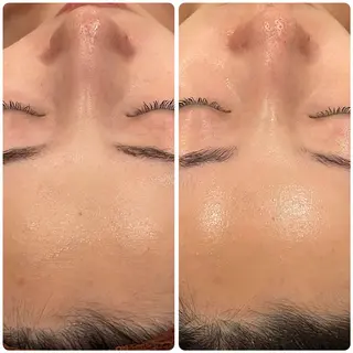 立体小顔×艶肌×美ボ ディ似合わせ施術 岡のエステ・リラクイメージ