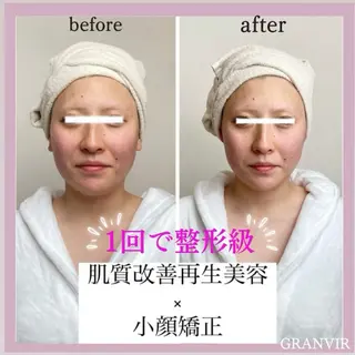 【福岡市西区 エステ】 GRANVIR(グランヴィール)所属・GRANVIR グランヴィールのエステ・リラクイメージ