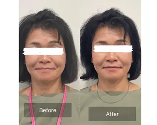 Loa Chaton YUMIのエステ・リラクイメージ