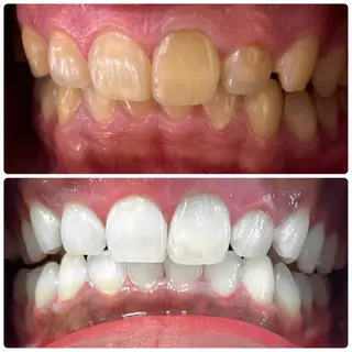 ホワイトニングルーム　川崎店所属・ホワイトニング ルーム　川崎店のその他イメージ