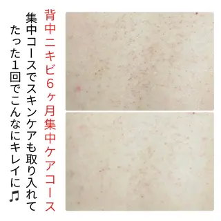 ベラージュ【美背中・ 美尻・フェイシャル】のエステ・リラクイメージ