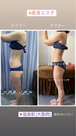 FLEUR大阪・整体 ・ハイフ・痩身・小顔のエステ・リラクイメージ